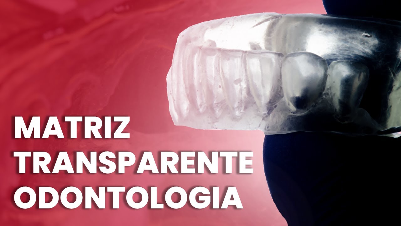 MATRIZ TRANSPARENTE ODONTOLOGIA - Mylene e Renato