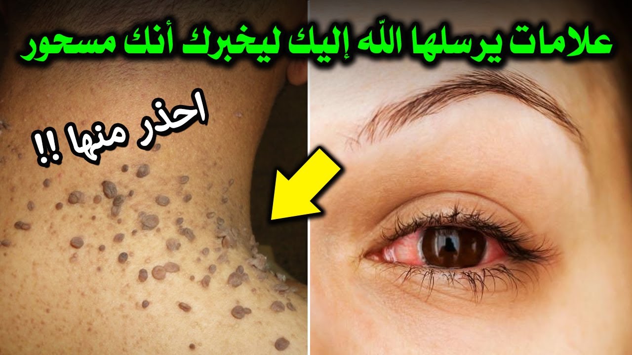 علامات اذا رأيتها فاعلم أنك مسحور وفي خطر شديد؟ احذر أن تراها وتغفل عنها؟