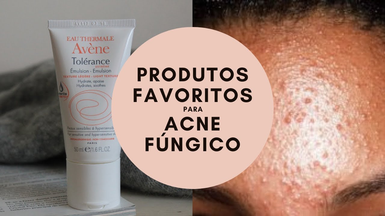 OS MEUS PRODUTOS FAVORITOS PARA ACNE FÚNGICO
