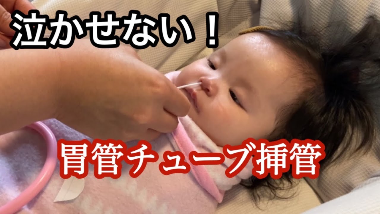 【4pマイナス症候群】もう泣かせない！胃管チューブ挿入。