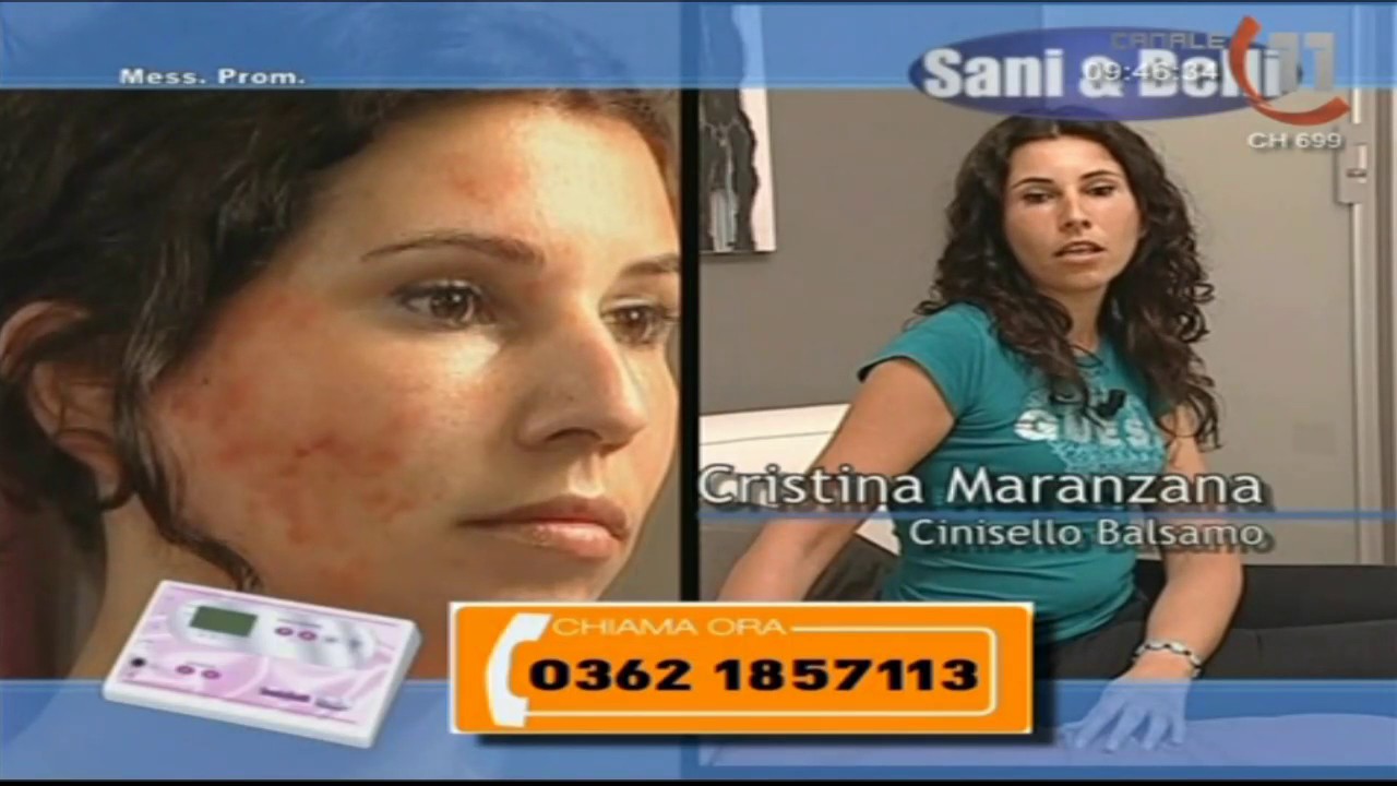 CANALE 11 LIVE STREAM