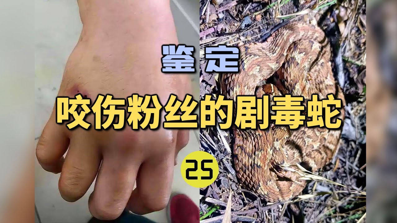 4K | 鉴定咬伤粉丝的毒蛇（25）网友的姑姑被毒蛇咬伤！发的全是网图？【世界记忆大师龙雅】