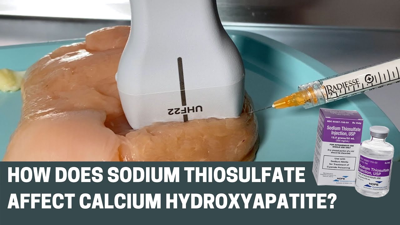 Does Sodium Thiosulfate (STS) Dissolve Calcium Hydroxyapatite (Radiesse)?