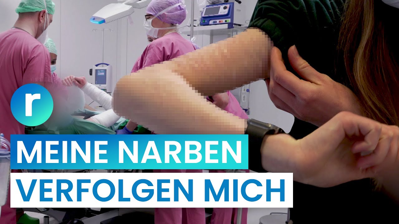 Meine Selbstverletzung ist Vergangenheit! Ich entferne meine Narben | reporter