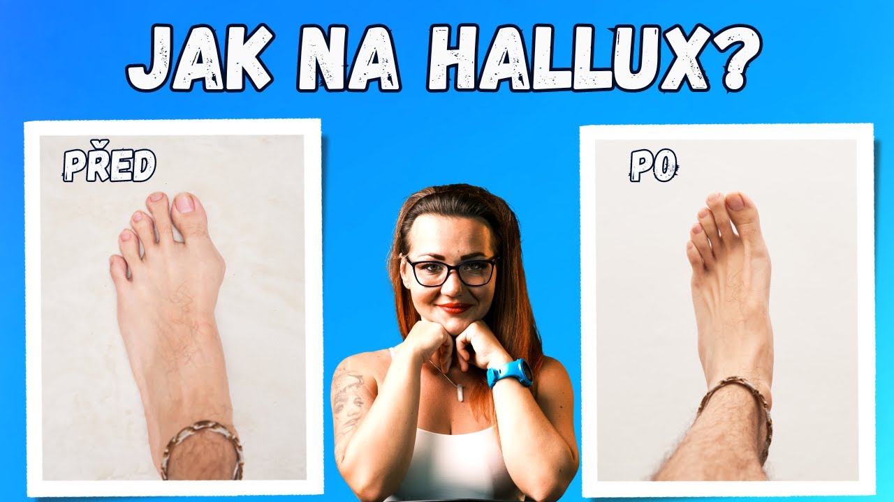 JAK ŘEŠIT VBOČENÉ PALCE - cviky na vbočené palce, uvolnění palce #pohyb #fyzioterapie
