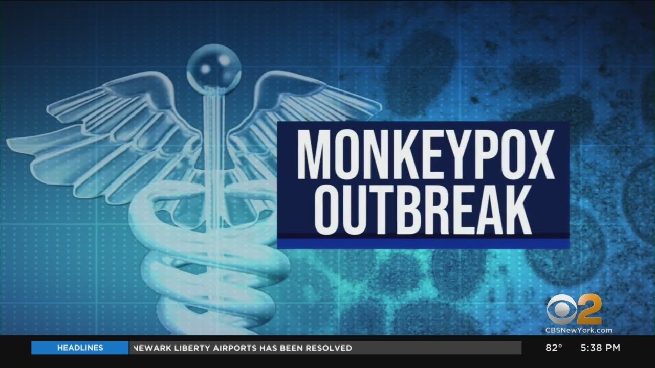 Health officials: 442K monkeypox vaccine doses available