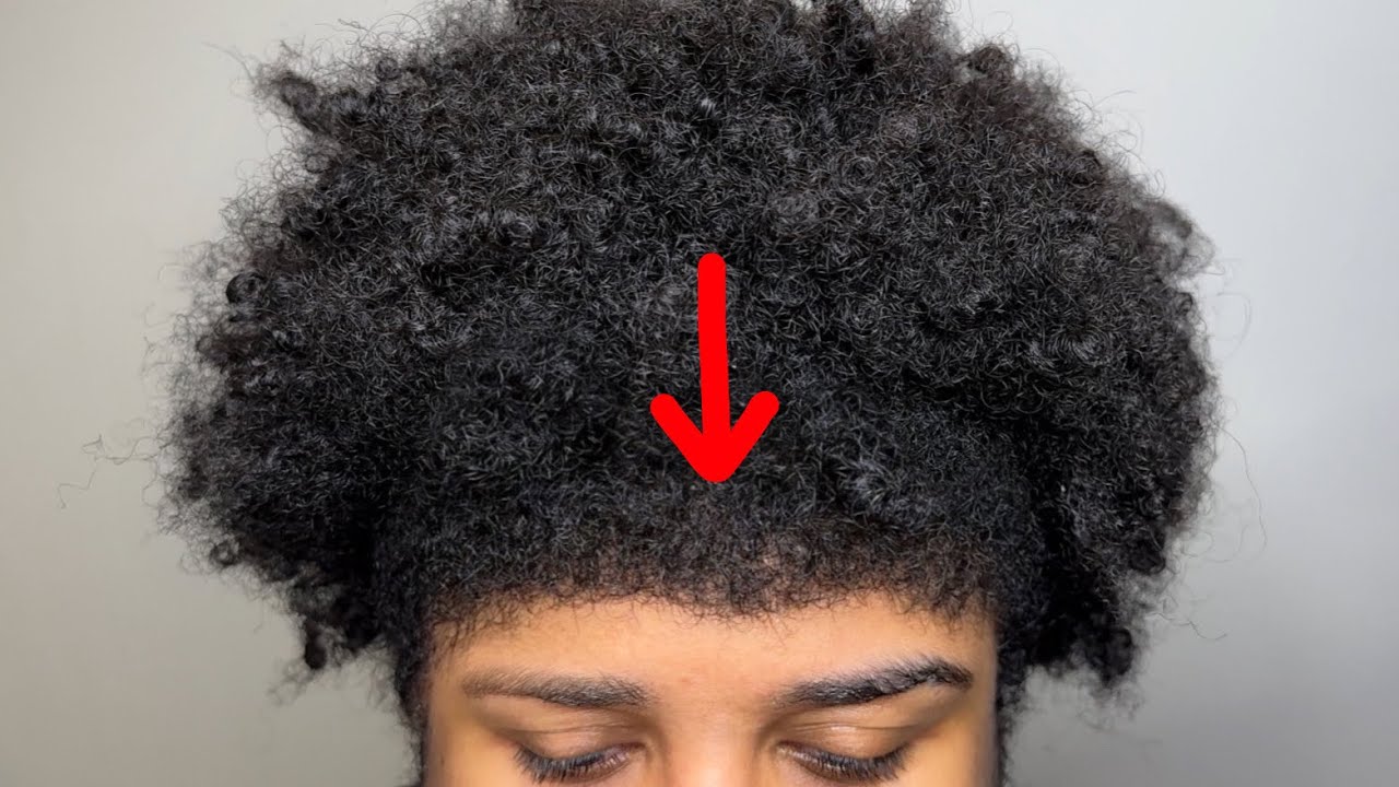 this MAN has a TINY hairline