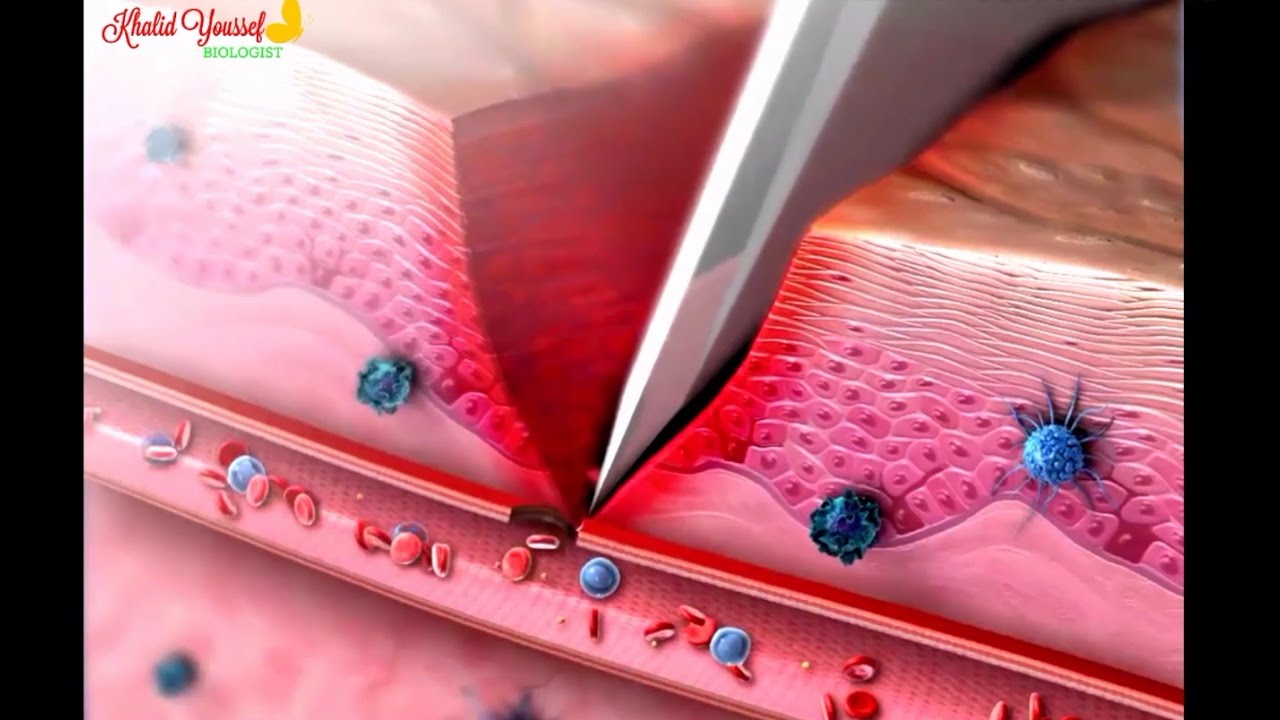 الإستجابة بالإلتهاب inflammatory response (خط الدفاع الثاني)
