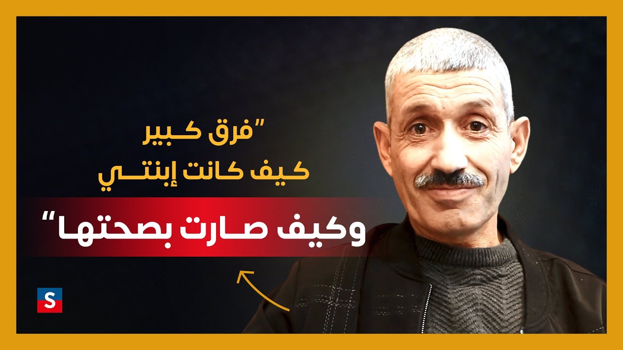 عملية زراعة الكبد في تركيا لعلاج التليف الكبدي