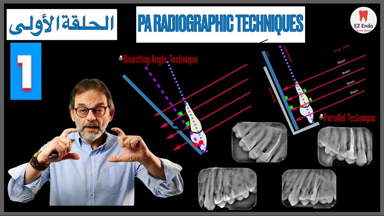 Taking Periapical Radiographs - I نصائح هامة لتصوير اشعة الأسنان آثناء علاج أقنية الجذور