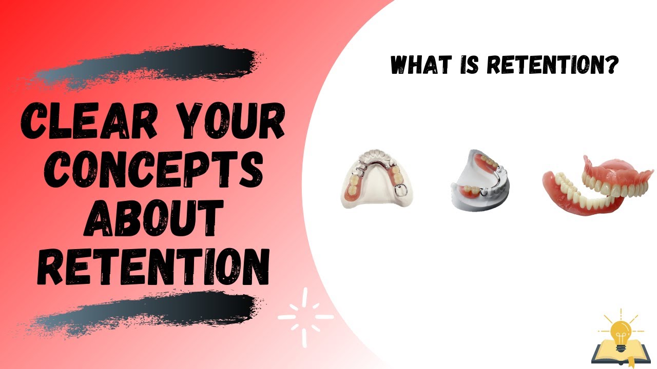 What is meant by Retention? | Basics of Prosthodontics