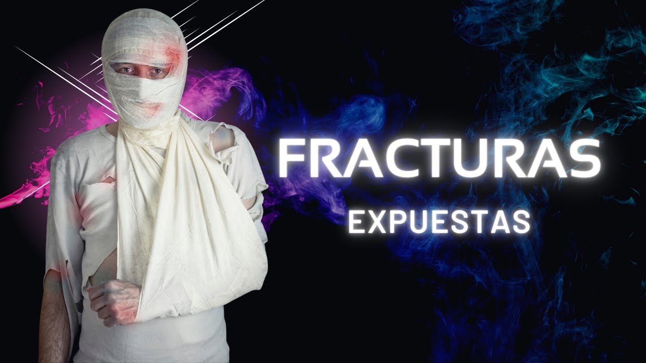 Fracturas expuestas - Lo básico que deberías de saber