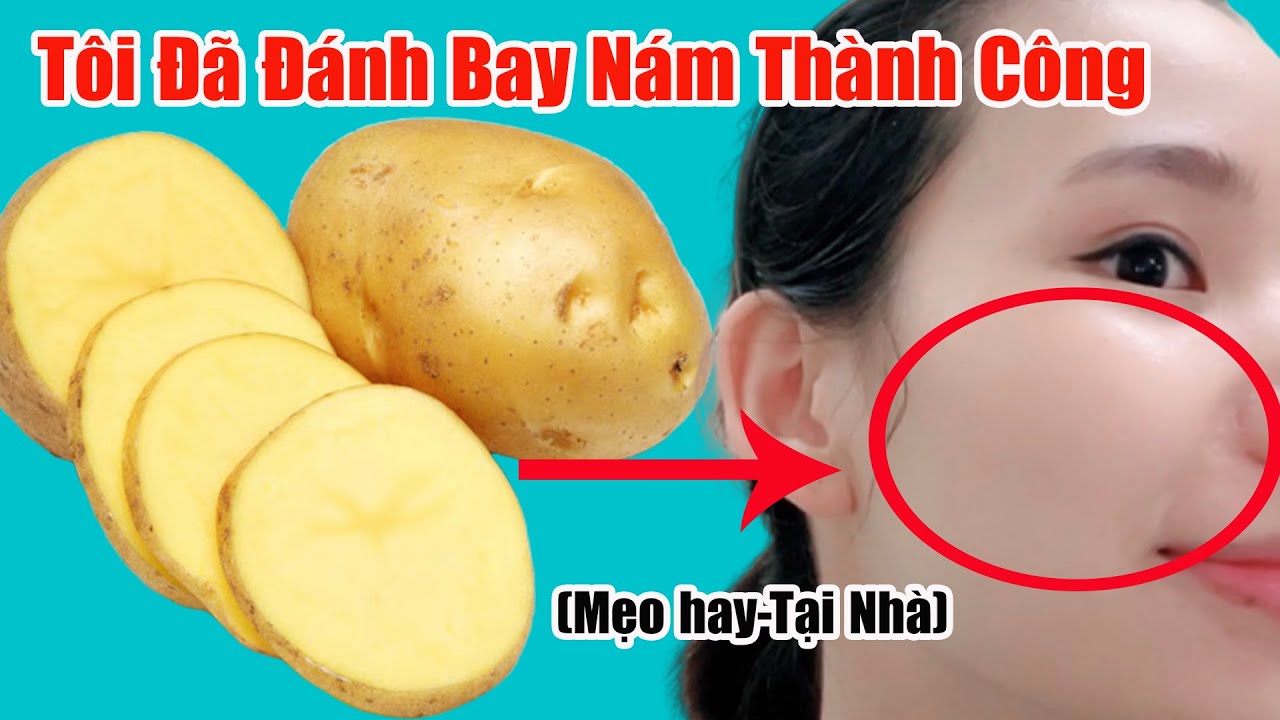 ️🍀 Mặt Nạ Trị Nám Và Tàn Nhang Siêu Hiệu Qủa Từ Khoai Tây Sữa Chua| Cẩm Nang Khỏe Đẹp