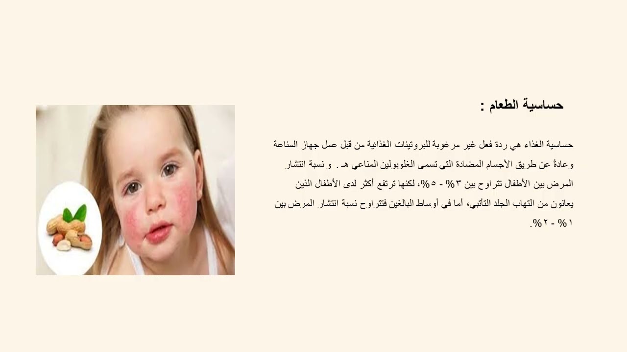 التوعية الغذائية
