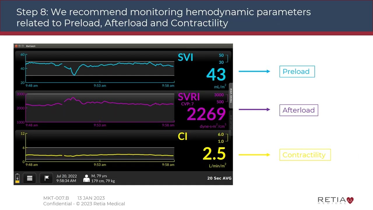 Argos Cardiac Output Monitor Training