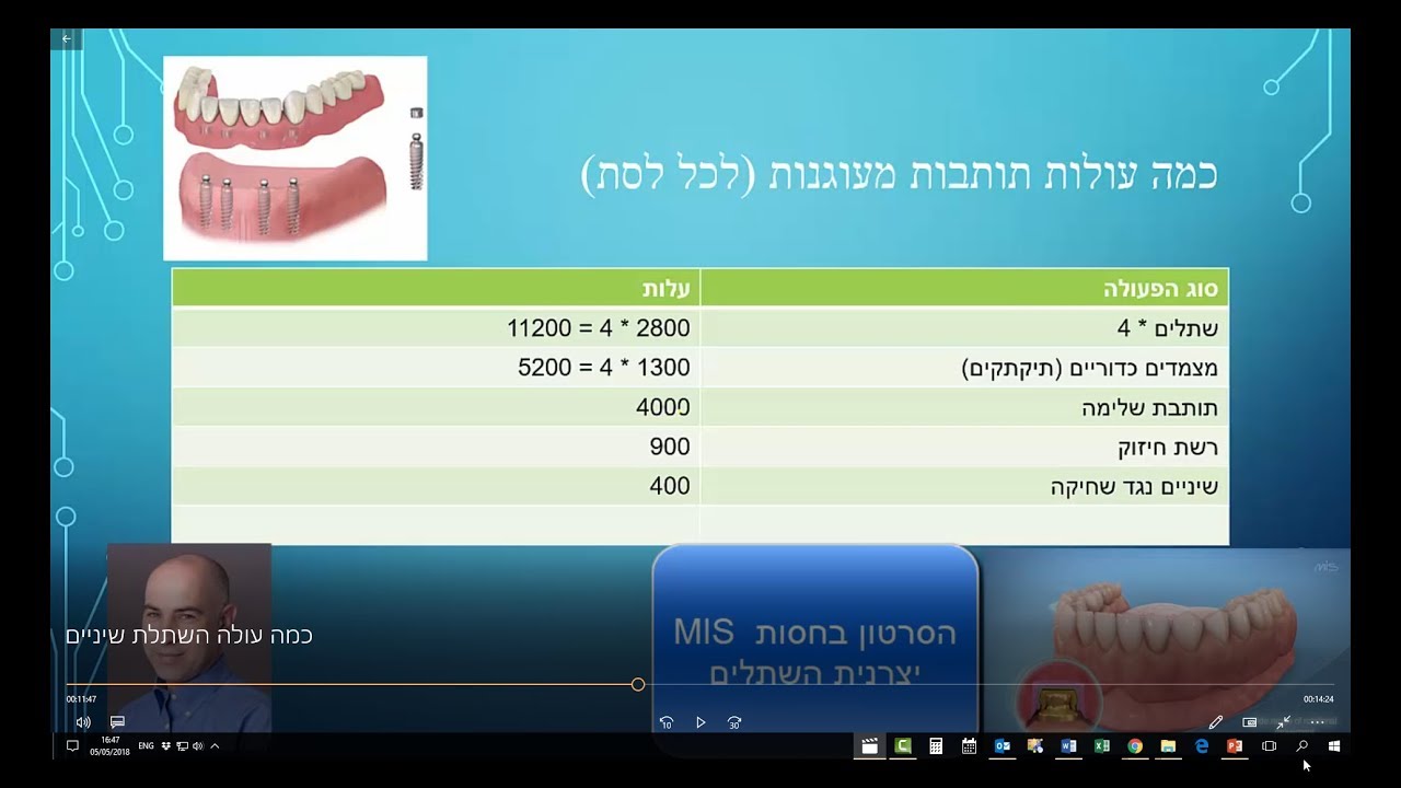 כמה עולה השתלת שיניים? התקשרו: 1-800-3000-54 / 1-800-3000-31
