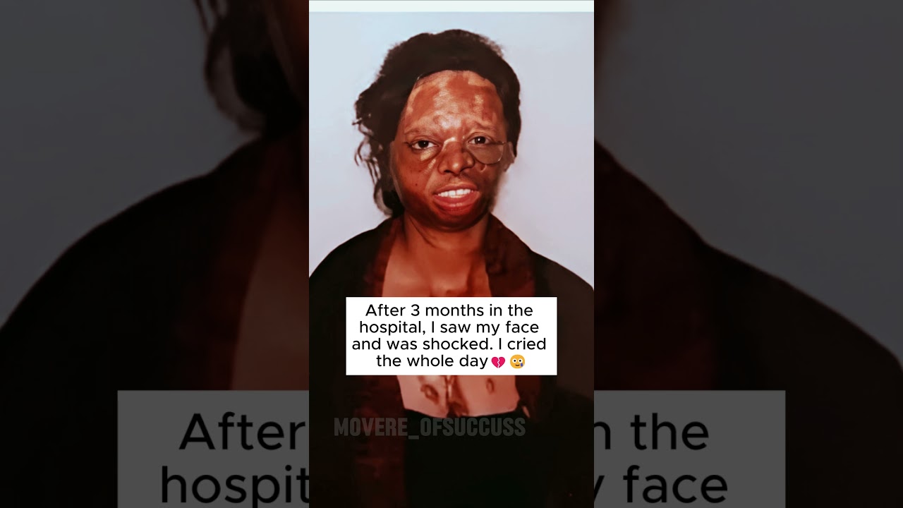 Survivor of an acid attack Lakshmi Agarwal💖🔥 #motivation #goals #shorts #viral