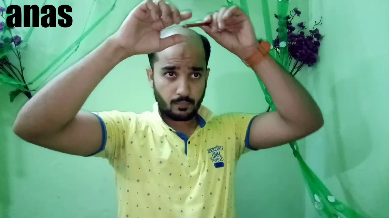 How to do hair patch self service at home, free consultant at wthatsap or call 9650914665 anas sheik