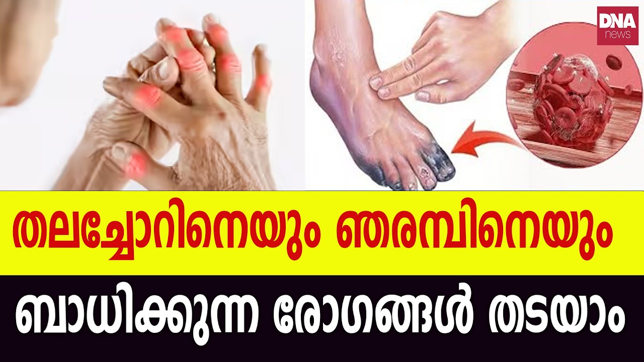 ഞരമ്പുകളിൽ രക്തയോട്ടം കൂട്ടാൻ കഴിക്കേണ്ട ഭക്ഷണങ്ങൾ | dnanewsmalayalam
