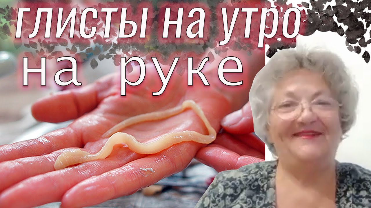 Как у меня вышли глисты