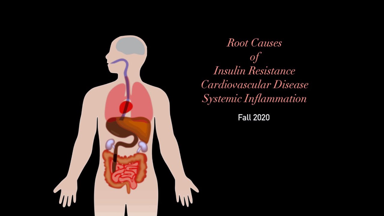 The Advanced Pathophysiology of Insulin Resistance, Metabolic Syndrome, and Cardiovascular Disease