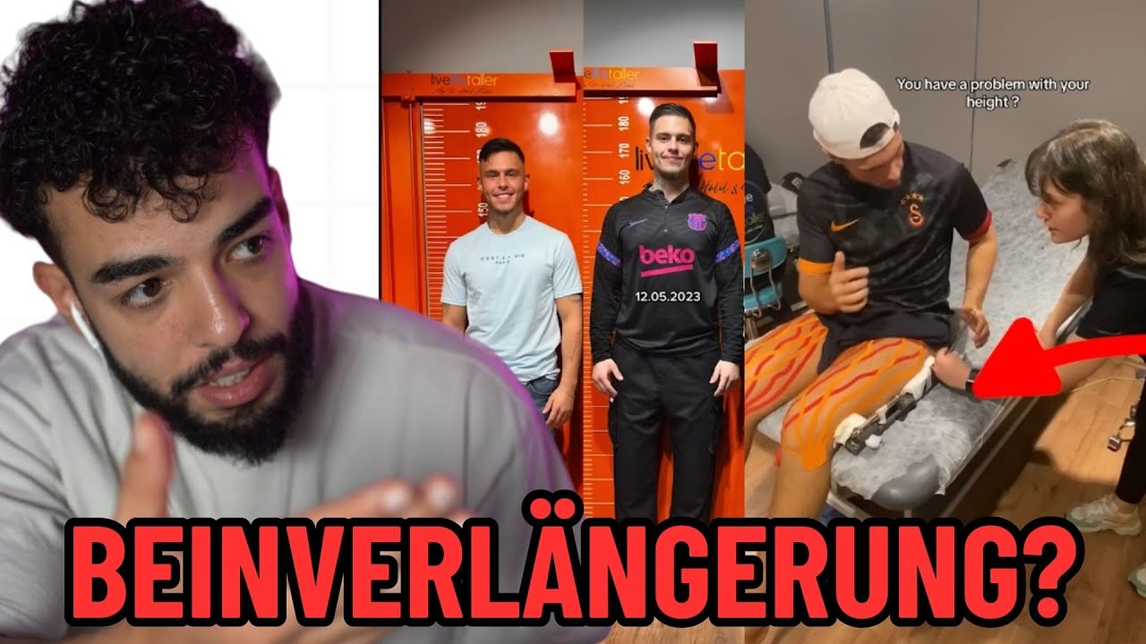 BEINVERLÄNGERUNG!? OP FÜR 35000?? SAMI REAKTION