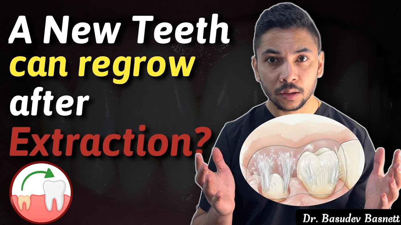 A New Teeth can grow after extraction in adults | Dentist Explains😳