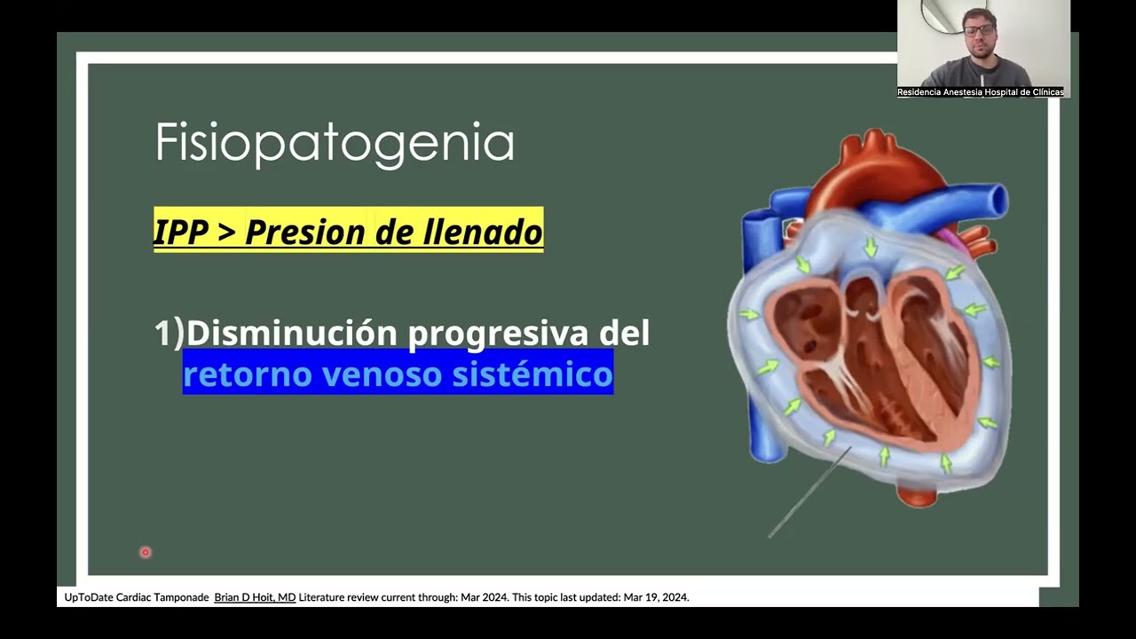 Shock Obstructivo