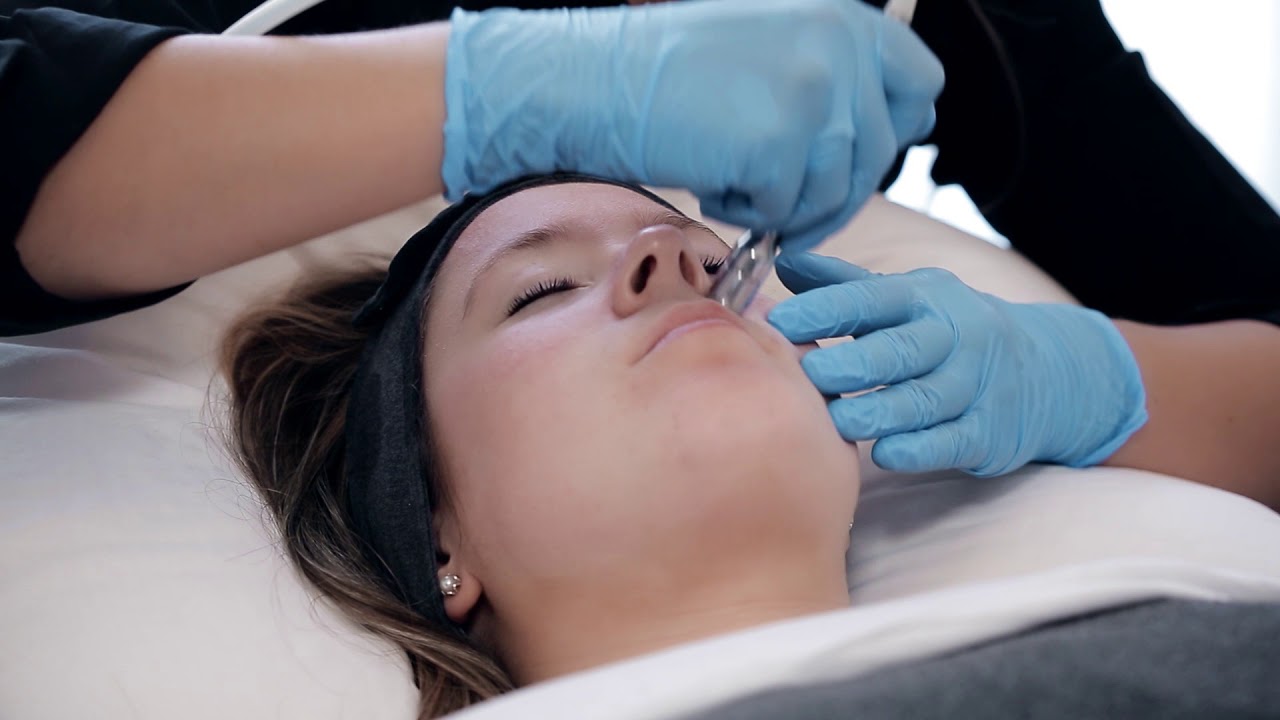 Microdermabrasion - Step by Step / Microdermabrasion - Étape par étape