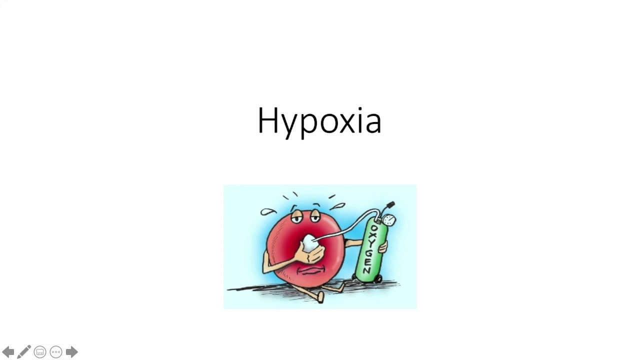Hypoxia and oxygen content - Primary FRCA Anaesthetics Revision