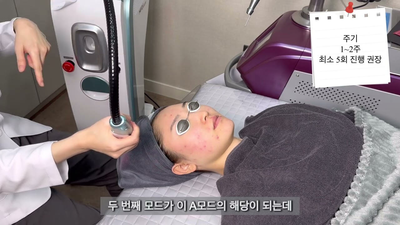 여드름 원인해결! 네오빔의 모든것
