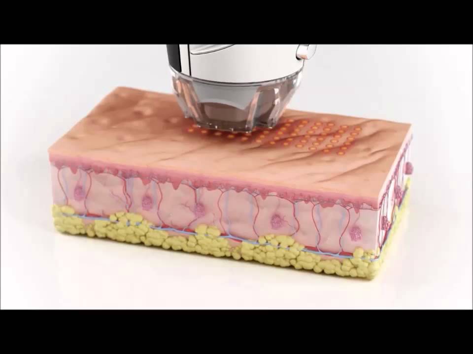 Etwo-Sublative Biological Animation