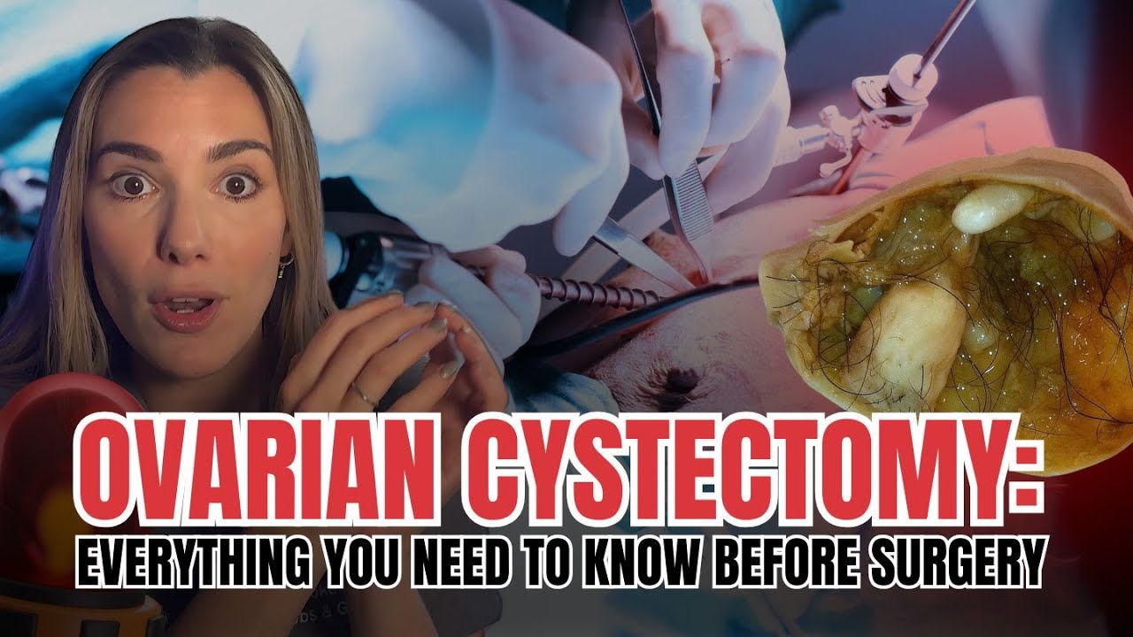 Ovarian Cystectomy: What to Expect Before, During & After Ovarian Cyst Surgery