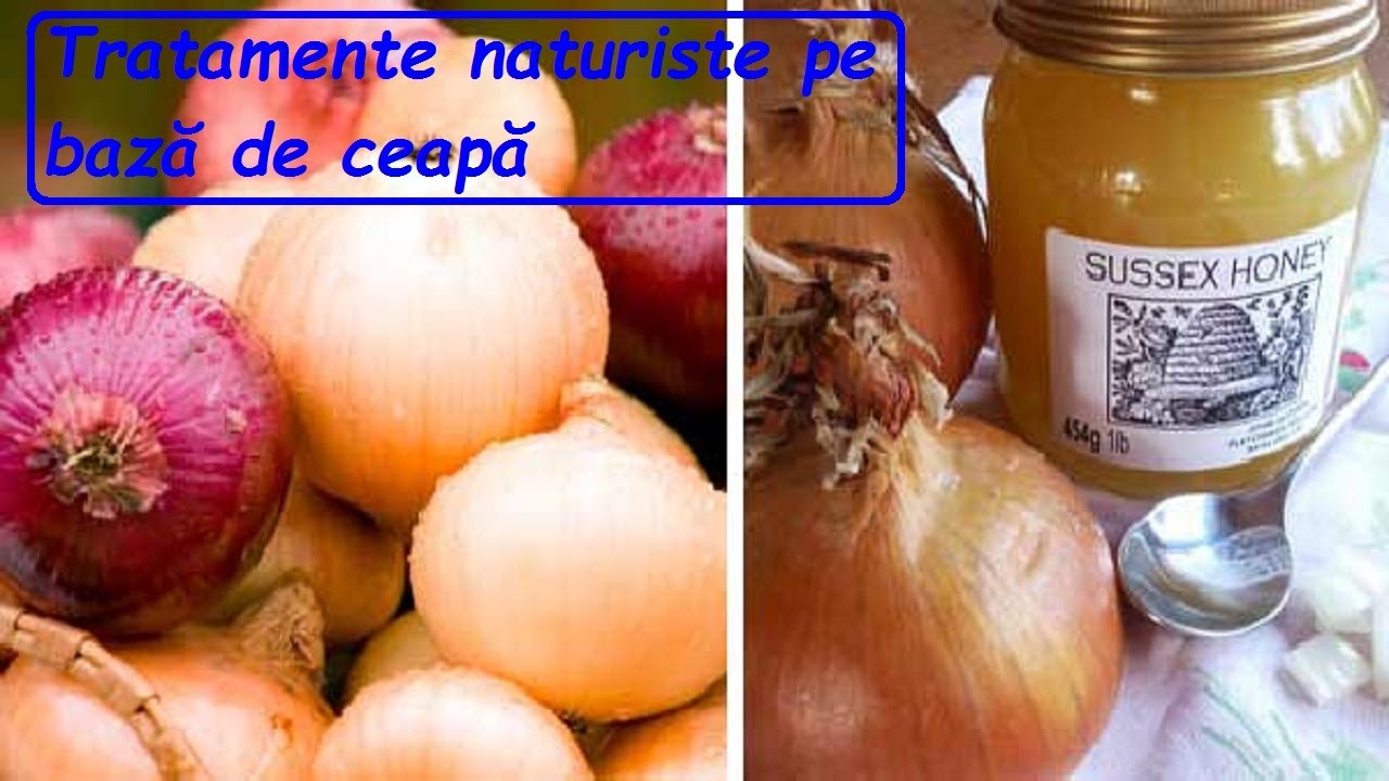 Tratamente naturiste pe bază de ceapă Iată ce boli și afecțiuni pot fi prevenite sau tratate cu ceap