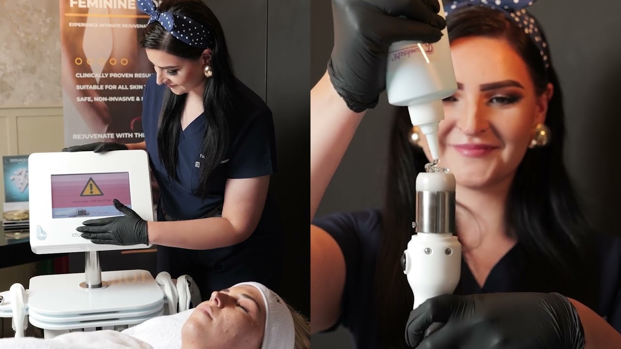 CFU Skin Tightening Treatment | Non-Surgical Facelift Results | Young Again Aesthetics