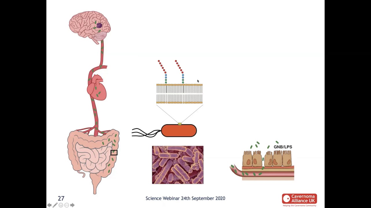 How the Gut Influences Cavernoma Formation with David White (Science of Cavernoma Series)