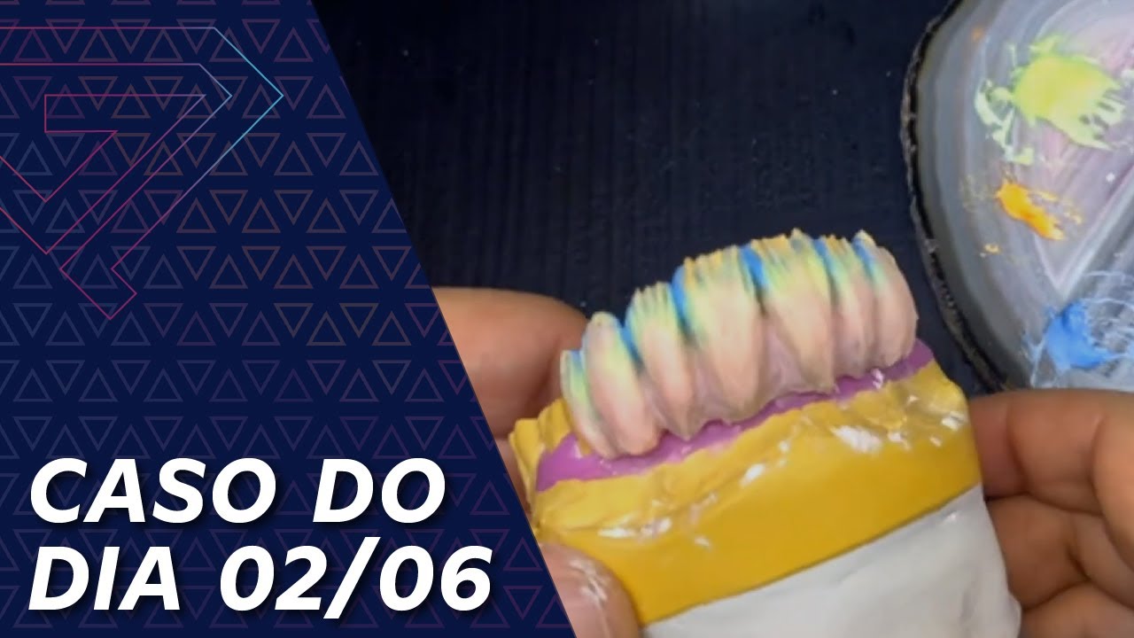 CASO DO DIA - 02/06/2021 | Ginetom Rodrigues
