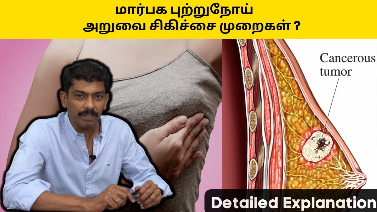 Surgical Management of Breast Cancer - Detailed Explanation| Dr.RavindranKumeran |Tamil Medical Tips