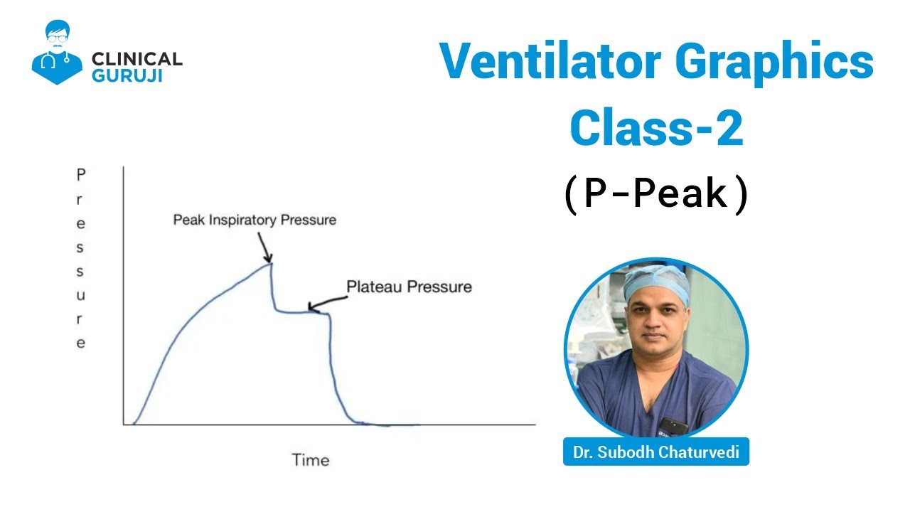 Ventilator Graphics Class -2 (P-Peak)