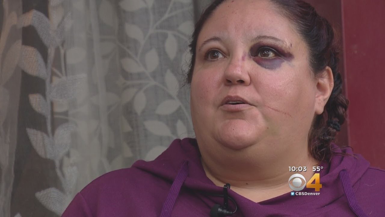 Woman Attacked After Asking Teens To 'Be Quiet'