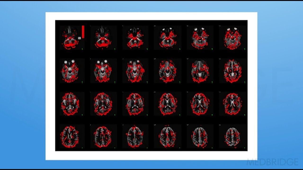 How Pain Works - Adriaan Louw | MedBridge