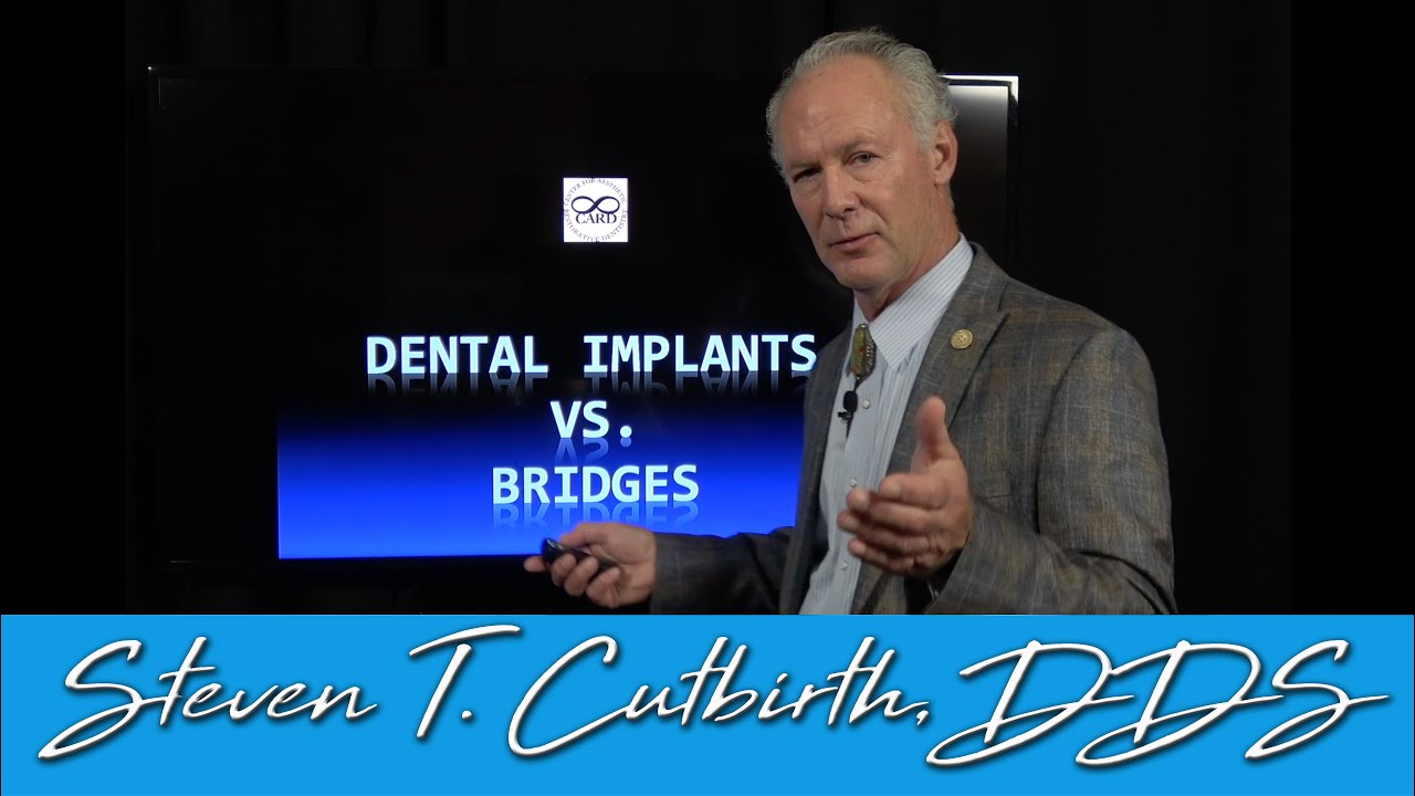 Dental Implants vs Fixed Bridge - Comparison - Dental Minute with Steven T. Cutbirth, DDS