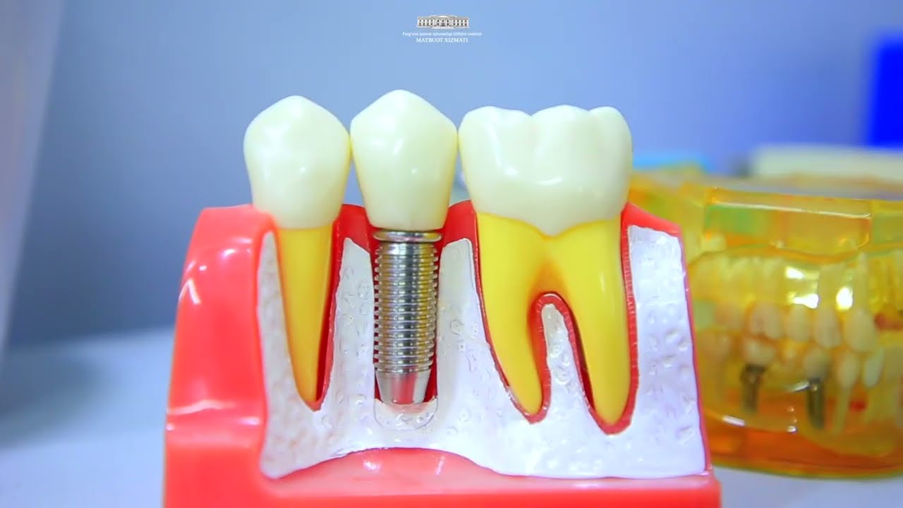 Tishsizlik(adentiya) haqida gaplashamiz