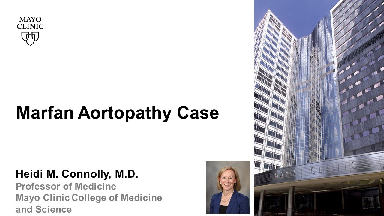 Marfan Aortopathy Case