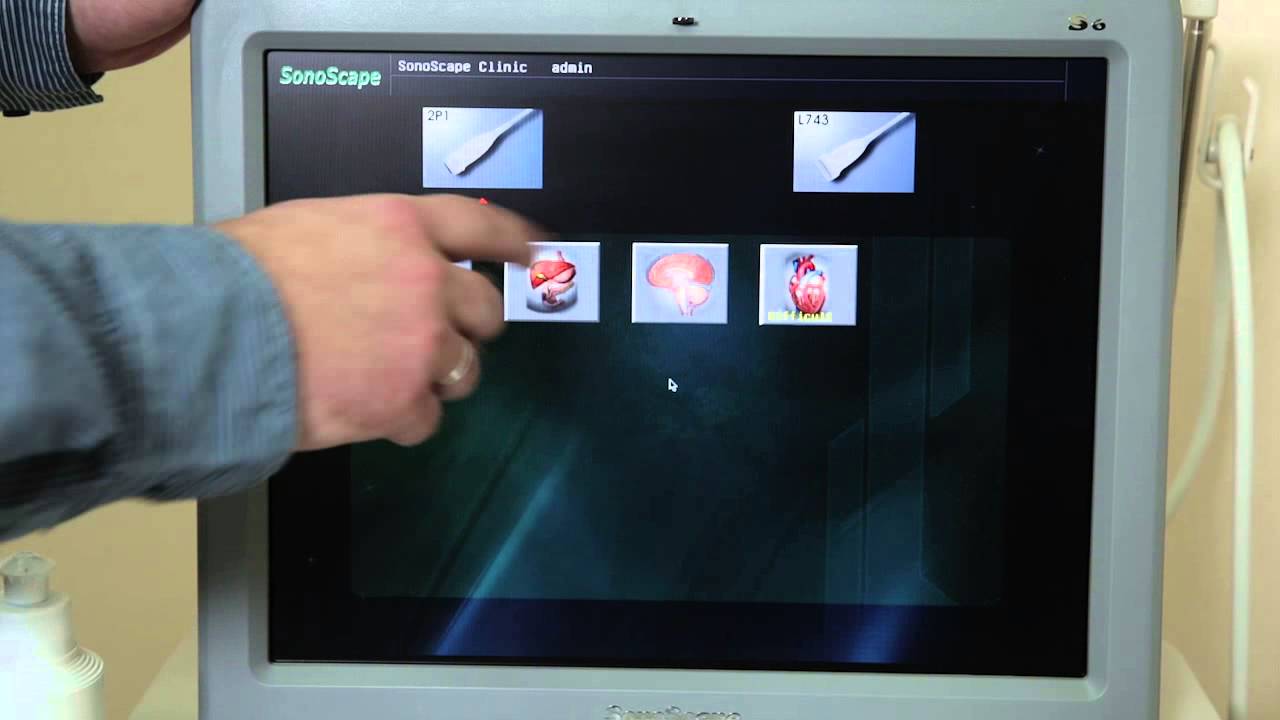 Sonoscape s6 pro - 01 Установка и подключение 720