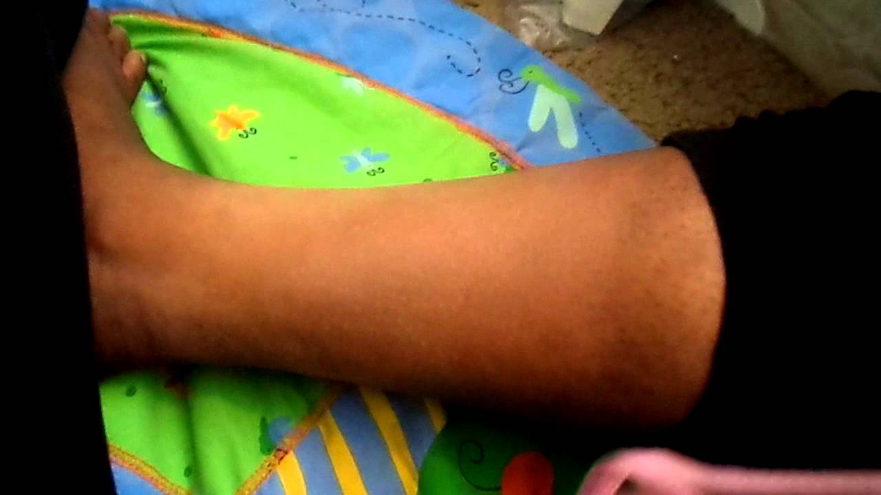 Dermablend (covering up scars on leg)