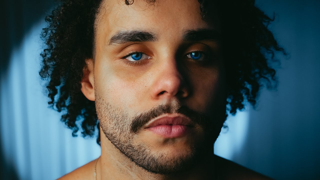 KOJO – Vitiligo