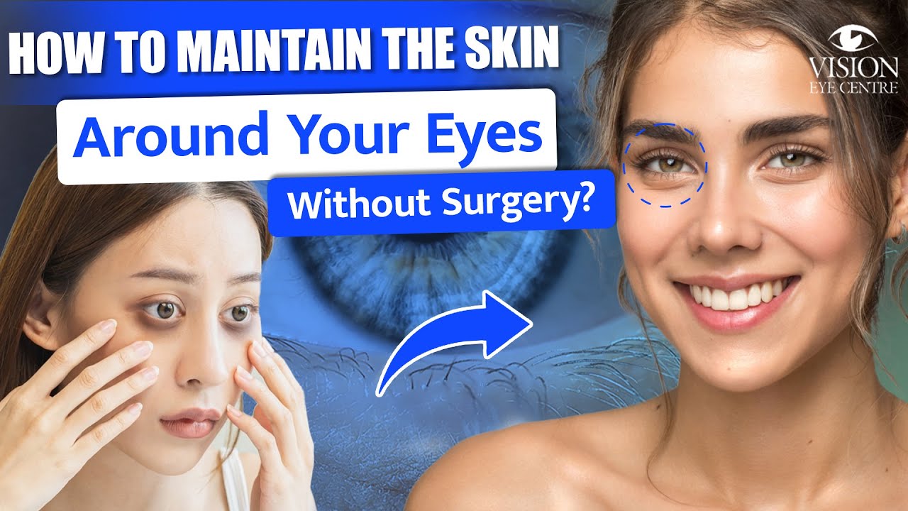 How to Maintain the Skin Around Your Eyes Without Surgery? | Ultimate Guide To Maintaining Eye Skin