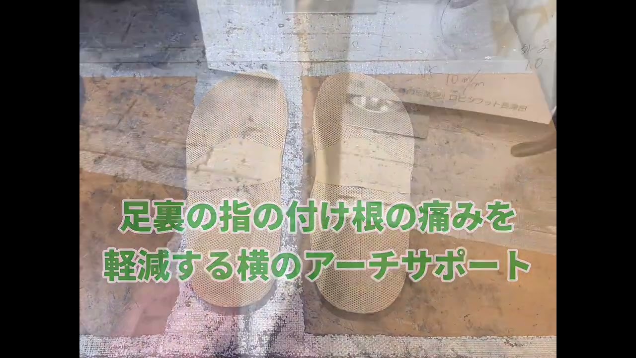 足の横アーチが低下して起きる「足のトラブル」