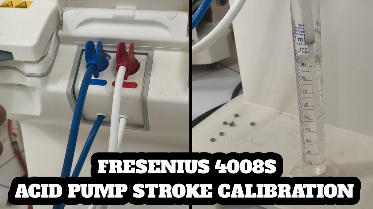 Калибровка кислотного насоса #fresenius4008s #acidpumpcalibration #strokescalibration